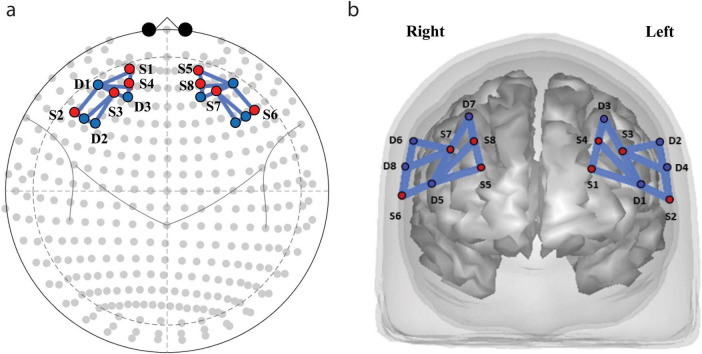 Difference between Okinawan and Dutch older adults in prefrontal brain activation.
