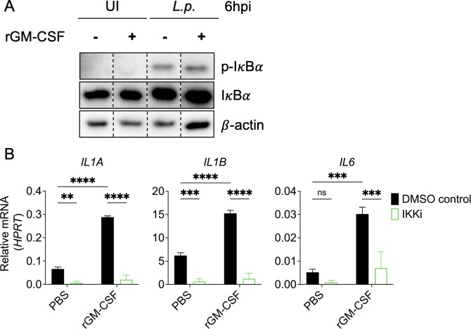 GM-CSF engages multiple signaling pathways to enhance pro-inflammatory cytokine responses in human monocytes during <i>Legionella</i> infection.