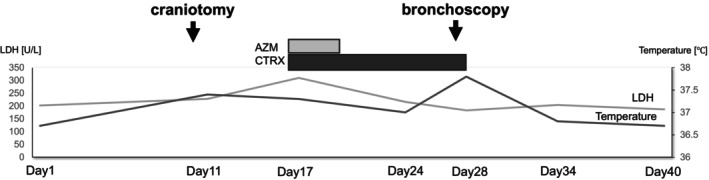 Regorafenib Induced Interstitial Pneumonia in a Patient With Refractory Rectal Cancer.