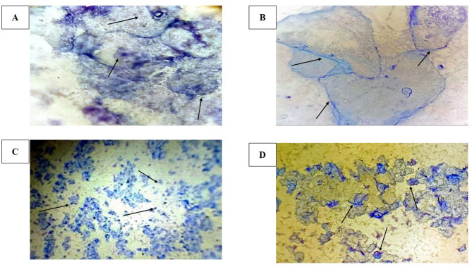 The effect of aqueous Stevia rebaudiana extract and clomiphene citrate on the expression of GDF9, PTEN, BMP15 genes, and antioxidant levels in a letrozole-induced polycystic ovary syndrome model in Wistar rats.