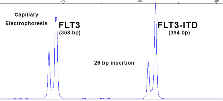 Multiclonal Profiling of FLT3-ITD in AML Using MinION Sequencing: A Tailored Clustering Approach to Enhance Subclonal Detection.