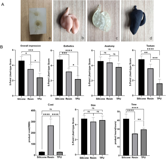 The novel technique for surgical simulation training of patient-specific silicone models of pediatric congenital choledochal cysts.