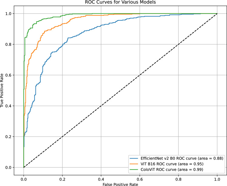 ColoViT: a synergistic integration of EfficientNet and vision transformers for advanced colon cancer detection.