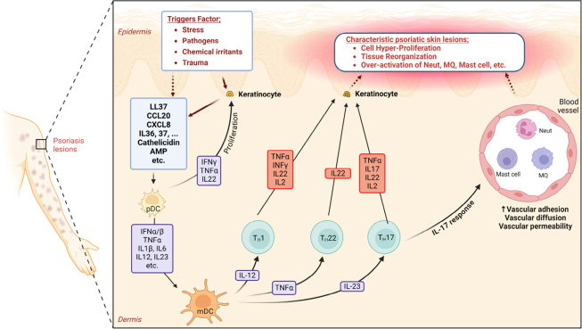 Stem Cell Therapy: A New Approach and Effective Treatment for Psoriasis.