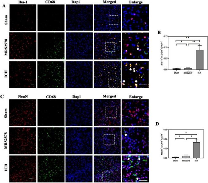 Inhibition of P2Y6 Receptor-Mediated Microglia Phagocytosis Aggravates Brain Injury in Mice of Intracerebral Hemorrhage.