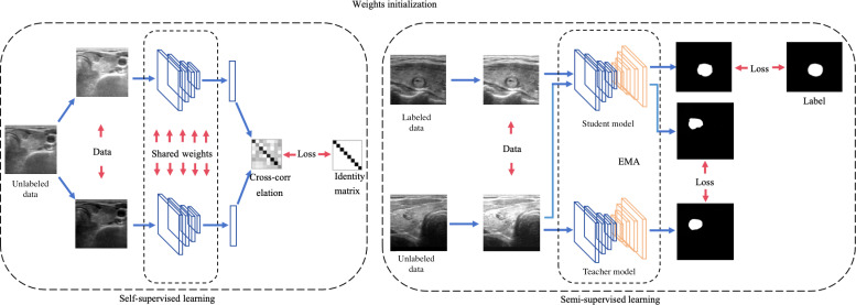 Optimizing Thyroid Nodule Management With Artificial Intelligence: Multicenter Retrospective Study on Reducing Unnecessary Fine Needle Aspirations.