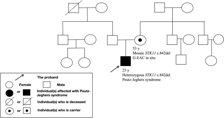Gastric-type endocervical adenocarcinoma in situ as the presenting feature in a mosaic STK11 pathogenic variant carrier with a Peutz-Jeghers syndrome child.