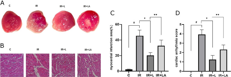 Levosimendan alleviates myocardial ischemia-reperfusion injury by regulating mitochondrial autophagy through cGAS-STING signaling pathway.