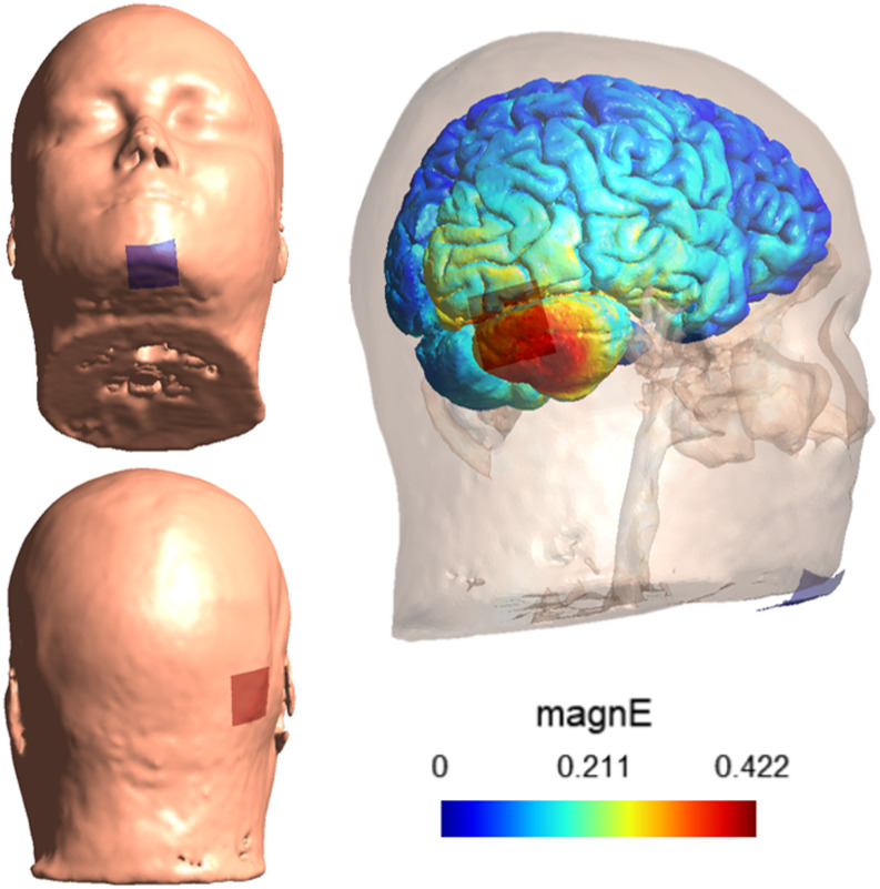 Differential Effects of Cerebellar tDCS on Sequential Mentalizing.