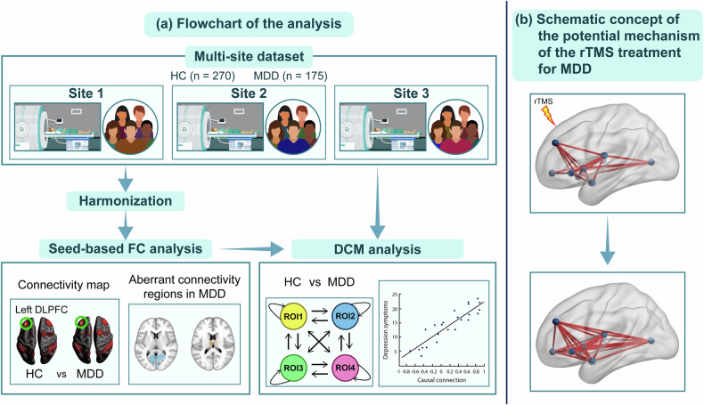 Exploring the capabilities of repetitive transcranial magnetic stimulation in major depressive disorder: Dynamic causal modeling of the neural network.