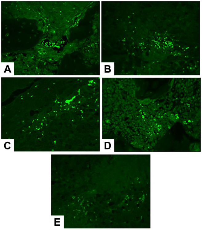 Effect of Zoledronic Acid Administration Timing on Metastatic Bone Tumors.
