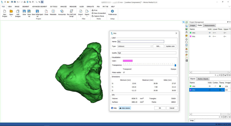 Evaluation of the relationship between sagittal skeletal discrepancies and maxillary sinus volume in adults using cone-beam computed tomography.