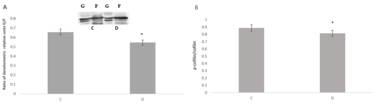 Sleep Deprivation in Rats Causes Dissociation of the Synaptic NMDA Receptor/D1 Dopamine Receptor Heterocomplex.