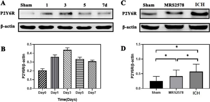 Inhibition of P2Y6 Receptor-Mediated Microglia Phagocytosis Aggravates Brain Injury in Mice of Intracerebral Hemorrhage.