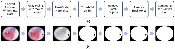 MST-AI: Skin Color Estimation in Skin Cancer Datasets.