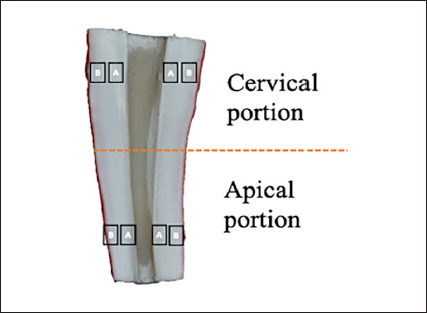 Antimicrobial Effectiveness of High-Power Sonic and Ultrasonic Devices Combined with Stepwise Intraoperative or Final Activation of Sodium Hypochlorite.