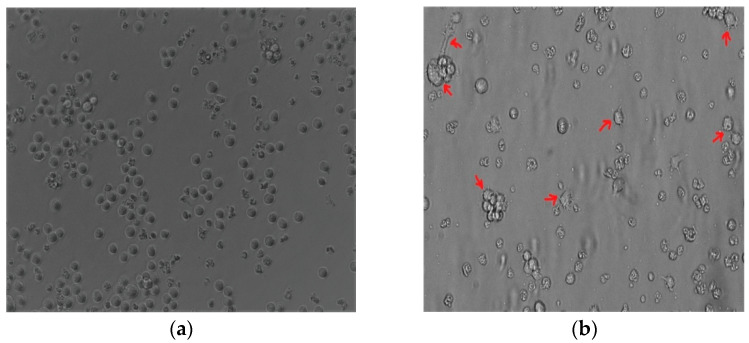 Role of Renin-Angiotensin System and Macrophages in Breast Cancer Microenvironment.