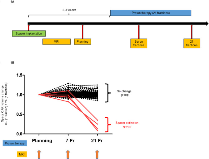 Evaluation of the changes in hydrogel spacer volume in patients treated with proton therapy for prostate cancer.
