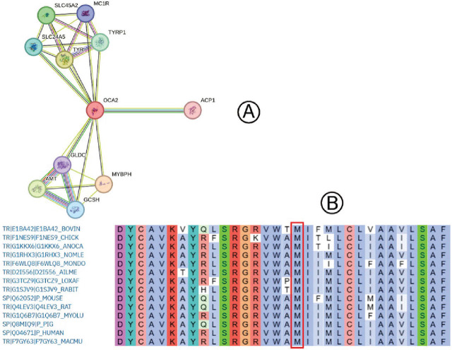 Oculocutaneous albinism in a patient with an <i>OCA2</i> variant: molecular and clinical insights.