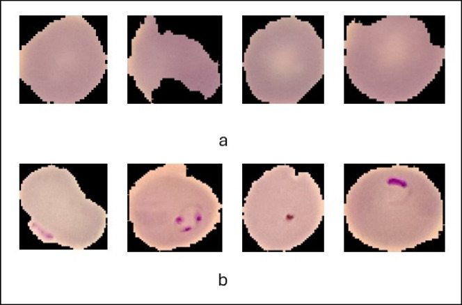Automated multi-model framework for malaria detection using deep learning and feature fusion.