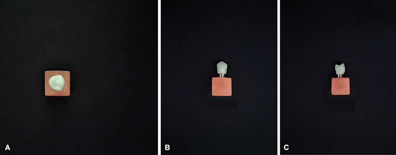 Comparison of Vertical Marginal Discrepancy in High and Low Translucent Monolithic Zirconia Crowns in Repeated Firing Cycles.