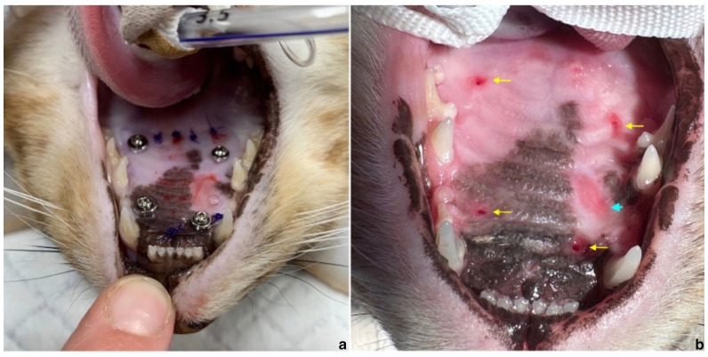Surgical application of a customised temporary palate guard to treat bleeding palatine ulcers in three cats.