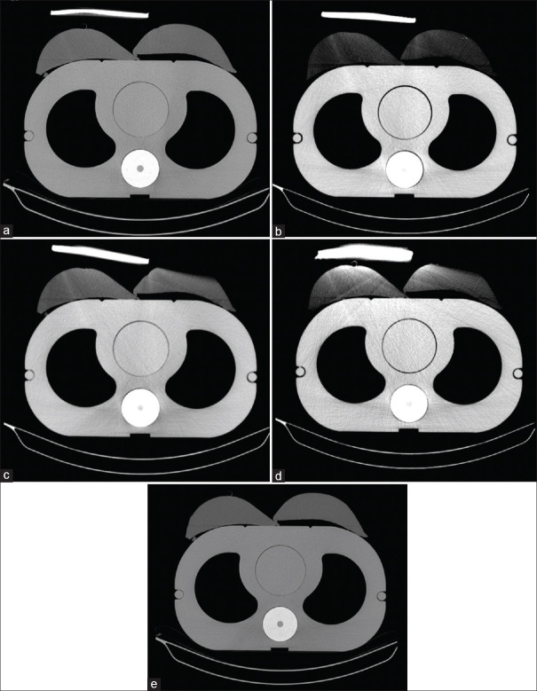 Balancing Radiation Dose Reduction and Image Quality in Chest Computed Tomography using Silicon Rubber-barium Sulfate Composite Shield.