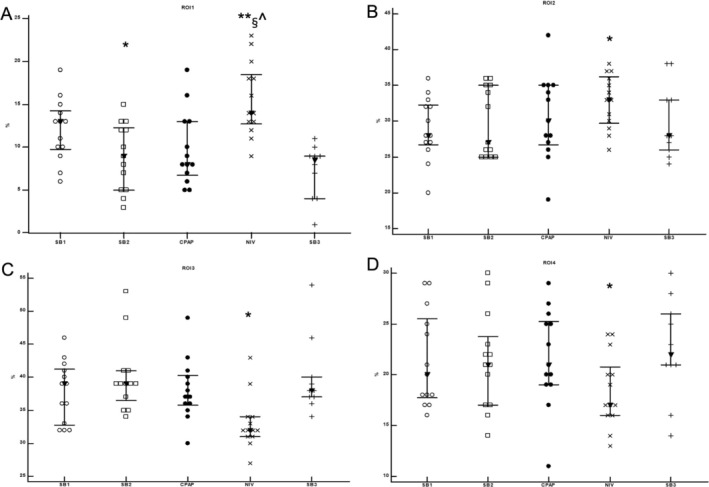 Effects of Noninvasive Respiratory Support on Ventilation Distribution During Spontaneous Breathing Sedation in Preschool/School-Aged Children: An Electrical Impedance Tomography Study.