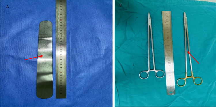 Application of an Intestinal Spatula in Optimizing a Sacrospinous Ligament Suspension.