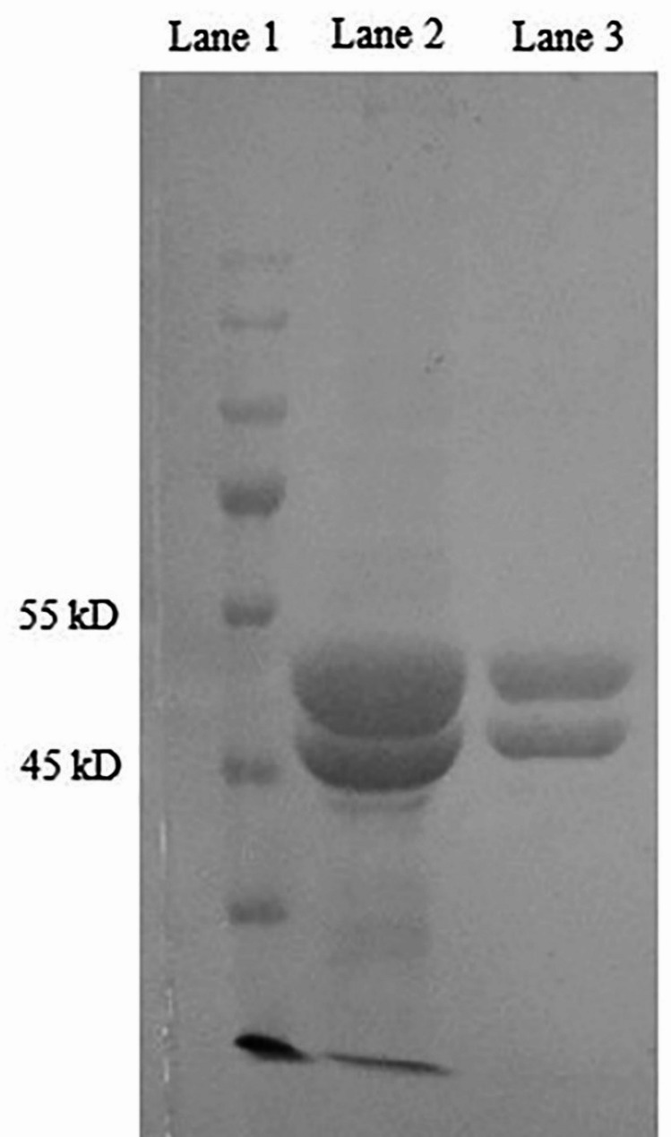 Structural changes of tubulin by interacting with Δ<sup>9</sup>-tetrahydrocannabinol: in-vitro and theoretical studies.