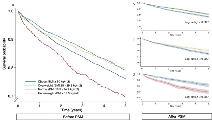 Impact of body mass index on outcomes of non-cystic fibrosis bronchiectasis.