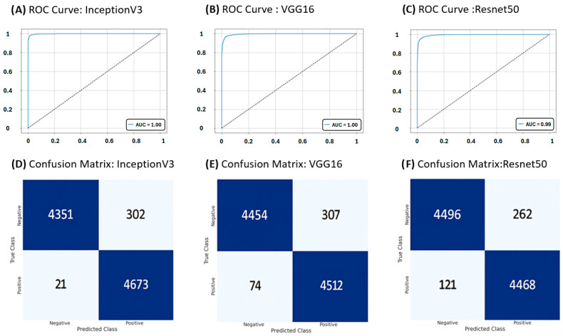 Detection of <i>Helicobacter pylori</i> Infection in Histopathological Gastric Biopsies Using Deep Learning Models.