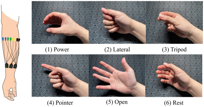 Pre-training, personalization, and self-calibration: all a neural network-based myoelectric decoder needs.