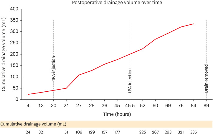 Tailored Tissue Plasminogen Factor Injection via Subdural Catheter for Subacute Subdural Hematoma in an Elderly Patient: A Case Report and Literature Review.