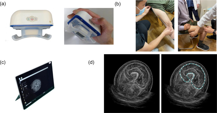 Usefulness of a newly developed ultrasonic system to estimate skeletal muscle mass and muscle strength in community-dwelling older adults.