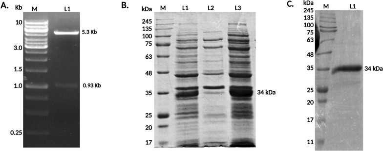 Recombinant Leishmania-activated C kinase as a novel antigenic candidate for immuno-diagnosis of visceral leishmaniasis occurring in India and Brazil.