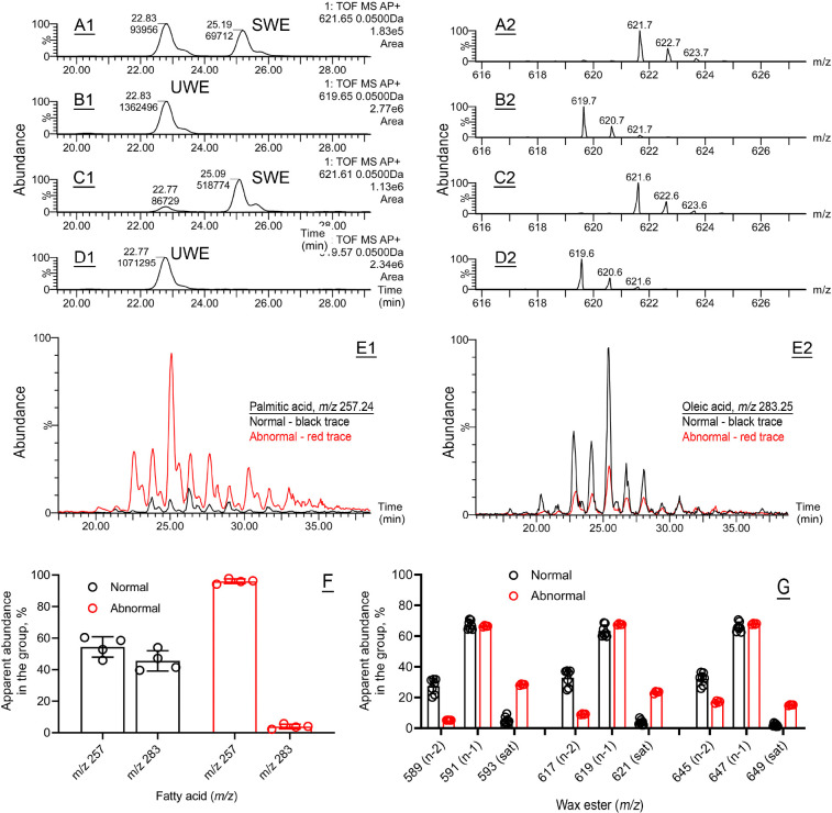 Abnormal Meibum Is Associated With SREBF1 Mutation And IFAP Syndrome-2.