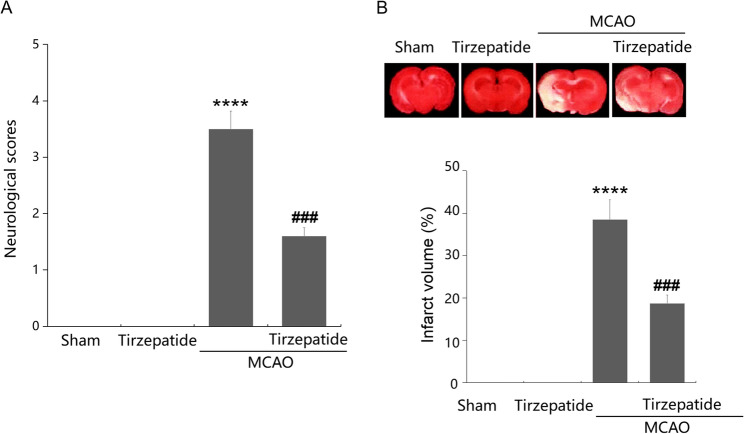 Tirzepatide mitigates Stroke-Induced Blood-Brain barrier disruption by modulating Claudin-1 and C/EBP-α pathways.