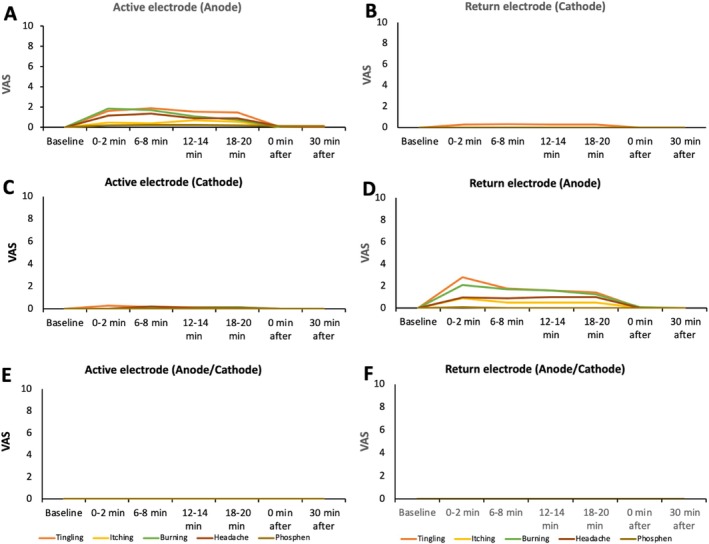 Effects of a Single Session 400 Hz Transcranial Pulsed Current Stimulation on Corticospinal and Corticocortical Excitability and Hand Dexterity: A Double-Blind RCT.
