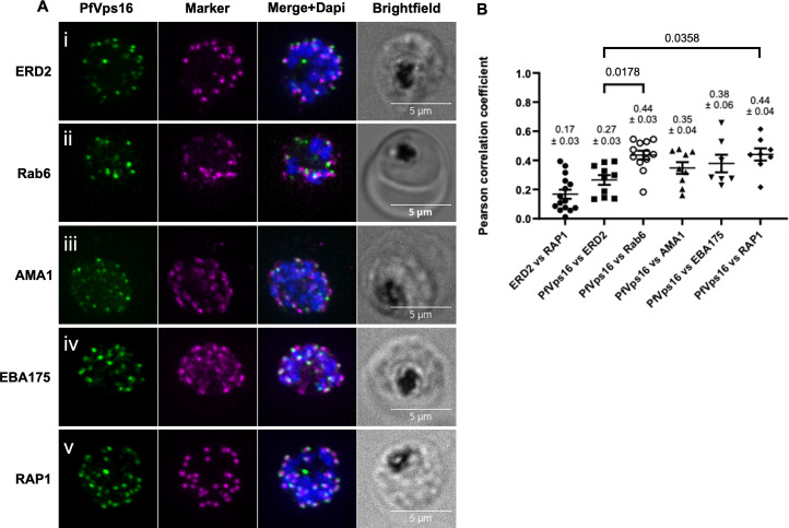 The <i>Plasmodium falciparum</i> homolog of Vps16 interacts with the core members of the Vps-C tethering complex.
