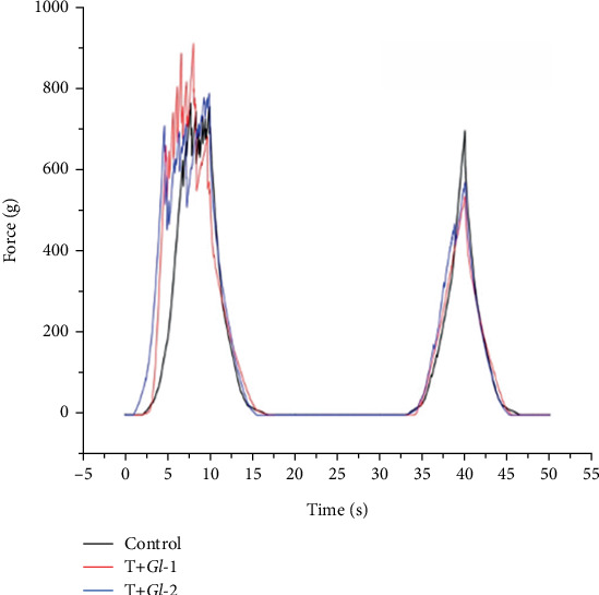 Characterisation and Hypolipidaemic Effects of Tlayudas, Widely Consumed Tortillas, Containing <i>Ganoderma lucidum</i> Extracts on an In Vivo Model of Hypercholesterolaemia.