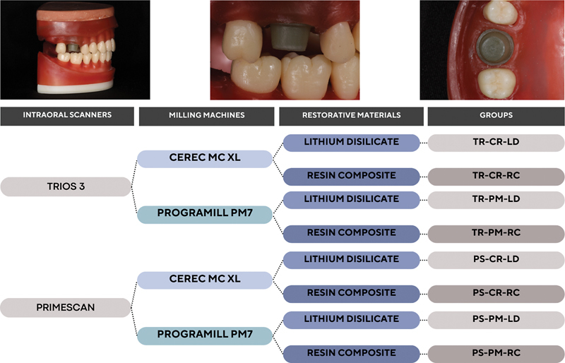 Comparative Analysis of CAD-CAM Workflow Variations on the Marginal and Internal Gaps and Fatigue Behavior of Ceramic and Resin Composite Dental Crowns.