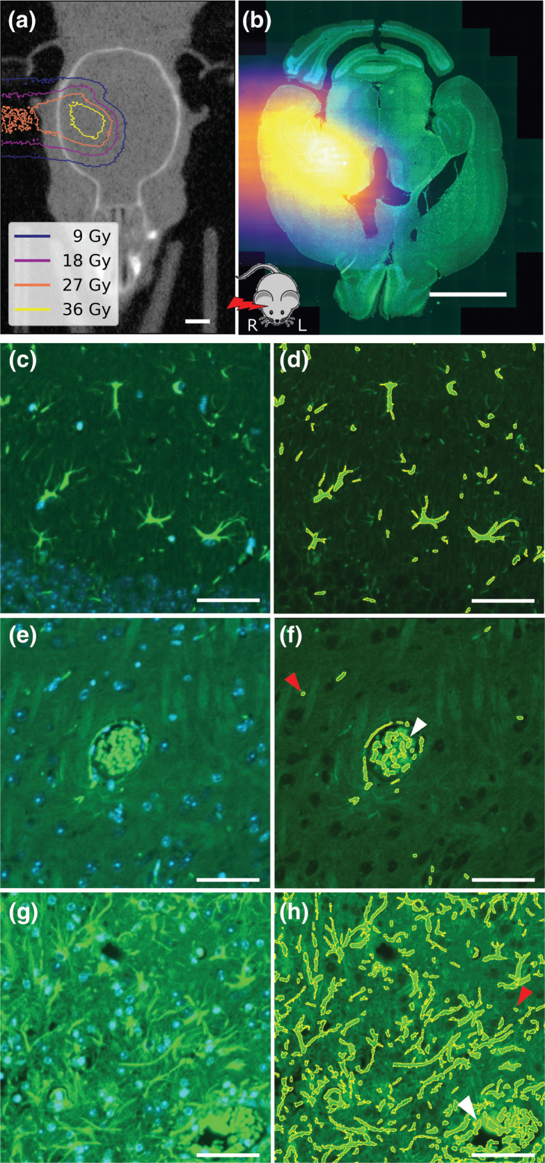 Radiation-induced changes of reactive astrocyte distribution in mice as a late response to partial-brain proton irradiation.