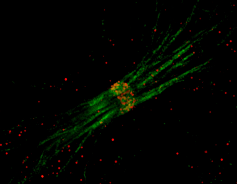 The multitalented TIP60 chromatin remodeling complex: wearing many hats in epigenetic regulation, cell division and diseases.