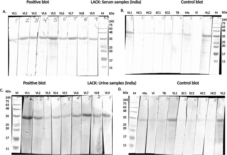 Recombinant Leishmania-activated C kinase as a novel antigenic candidate for immuno-diagnosis of visceral leishmaniasis occurring in India and Brazil.