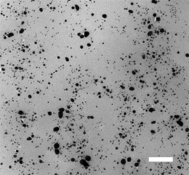 Management of Enterococcus faecalis associated endodontic infection using gold nanogel: An in-vitro study.