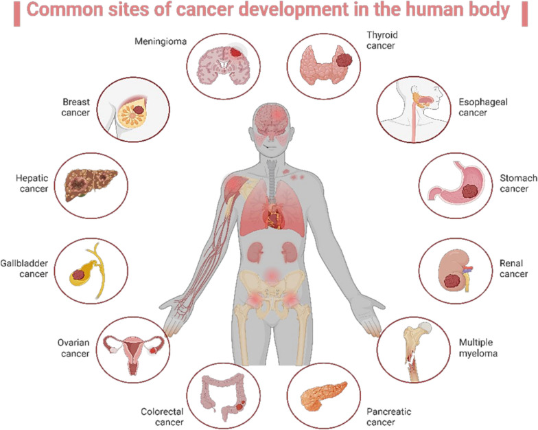 Medicinal plants: nutritional, immunological and therapeutic role in treating cancer-related malnutrition: a comprehensive review.