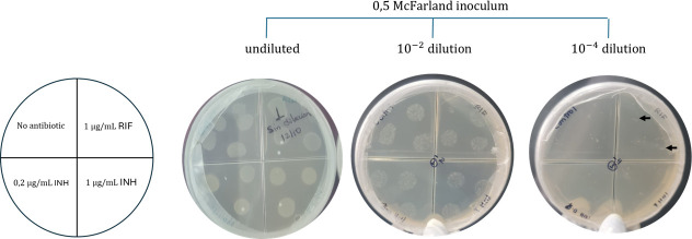 Dissecting rifampicin heteroresistance in <i>Mycobacterium tuberculosis</i>: integrating whole-genome sequencing with phenotypic and clonal validation.
