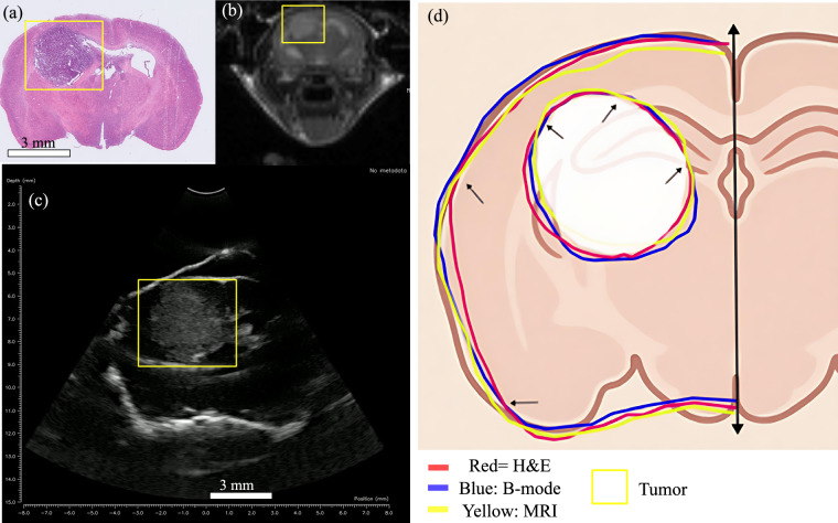 High-Resolution Ultrasound Data for AI-Based Segmentation in Mouse Brain Tumor.