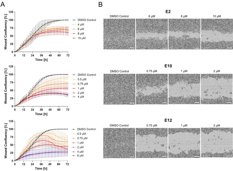 Novel High-Throughput Screen Identified S100A4 Inhibitors for Anti-Metastatic Therapy.